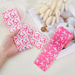 2Rolls 2 Colors Awareness Ribbon Pattern Polyester Ribbon&nbsp;OCOR-DC0001-31