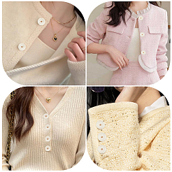 50Pcs 5 Styles 1-Hole Resin Shank Buttons&nbsp;BUTT-CY0001-43